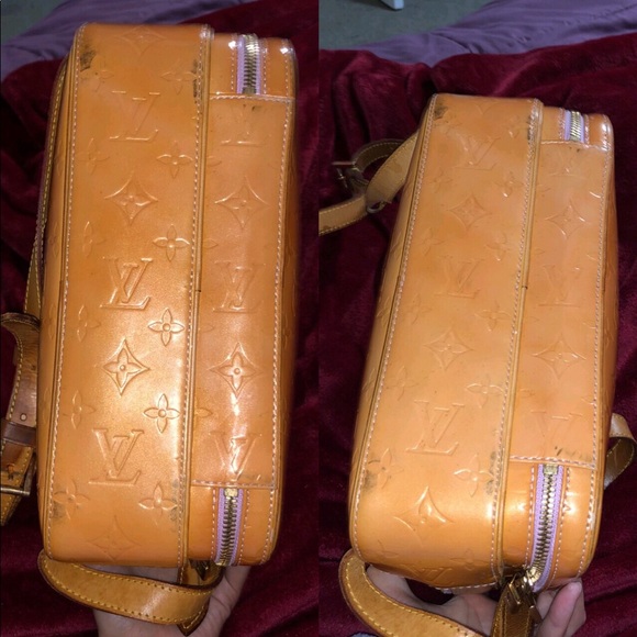 Authentic LV Vernis Murray Backpack Vintage - Picture 4 of 8